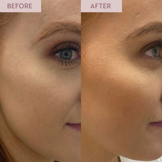 Facial Tanning Bundle (golden glow)